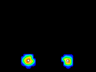 Esame baropodometrico - @dapratopostura